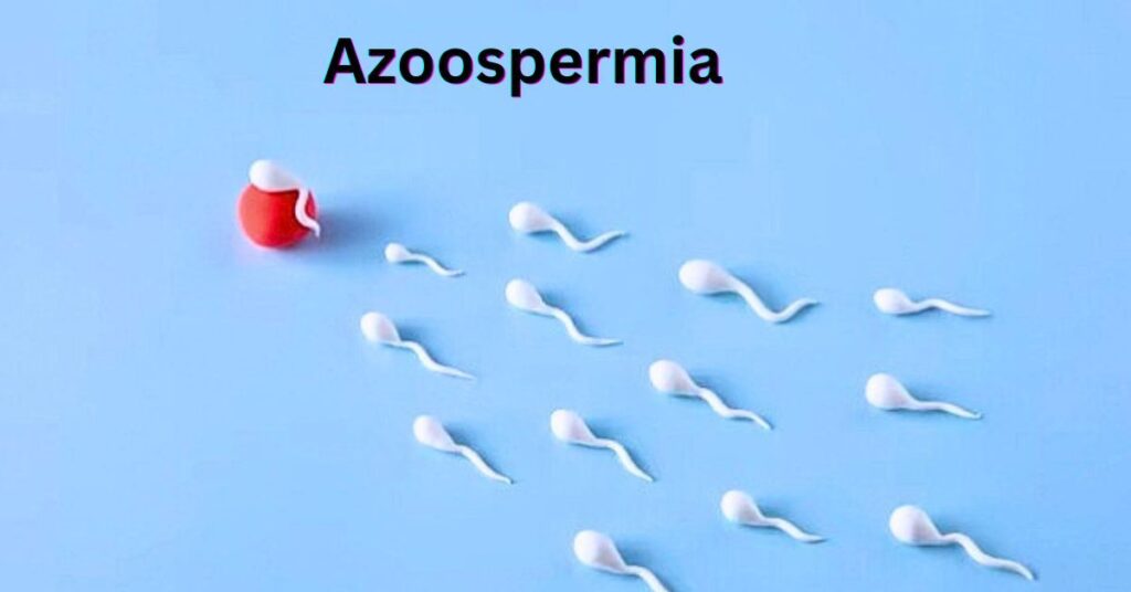 Know the Symptoms And Treatment of Azoospermia 